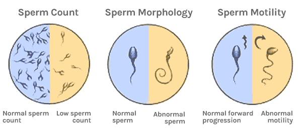 Different colors of sperm