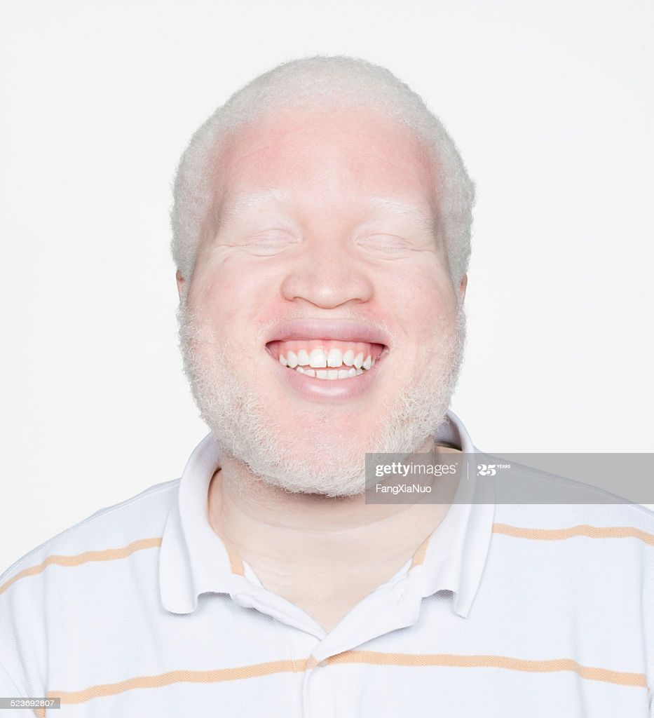 Albino Twink
