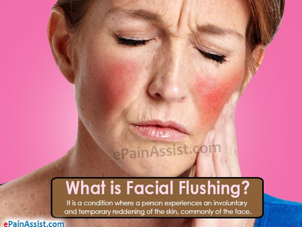 FD reccomend Pictures of facial flushing