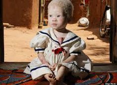 best of Picture Albino midget
