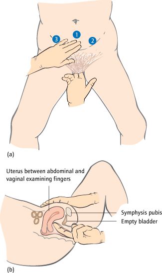 best of Photos Vulva examination