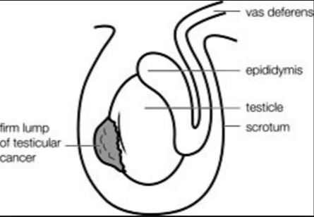 best of Sperm causes of knot Buildup