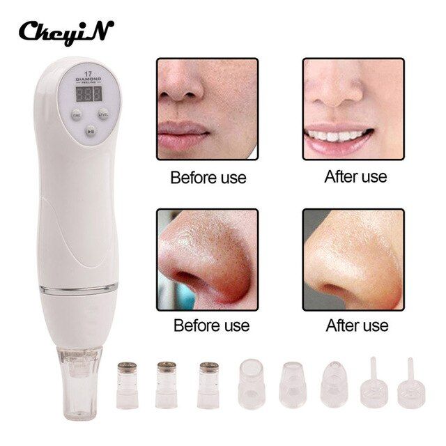 Facial spa ultra cleaning and microdermabrasion system