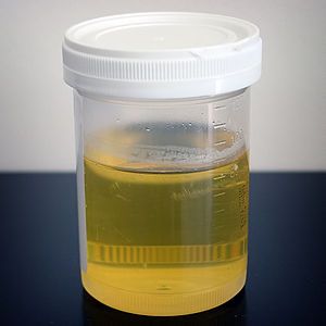 Cheese reccomend Community piss type