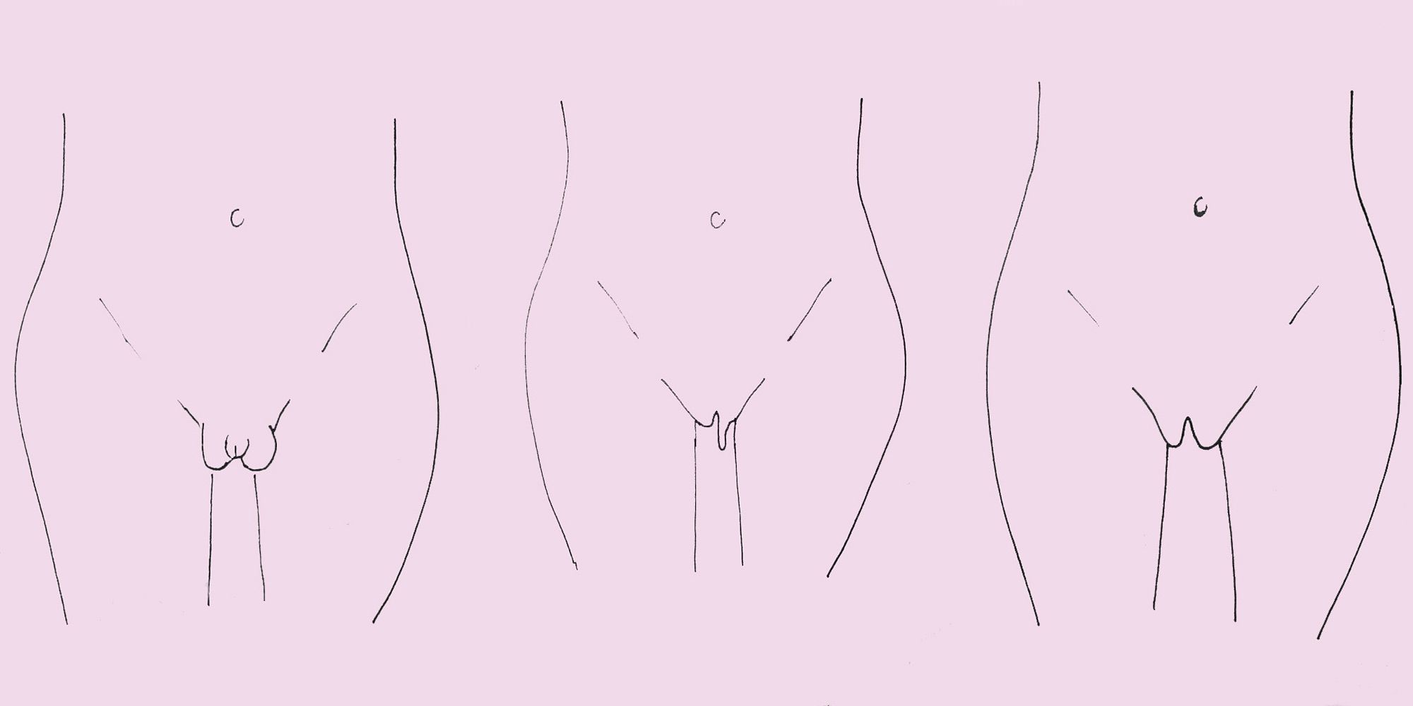 best of Large vulva Abnormally