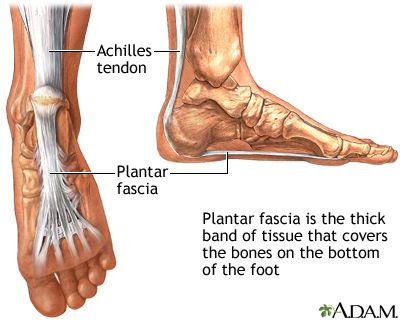Zelda reccomend Foot walking pain bottom arch