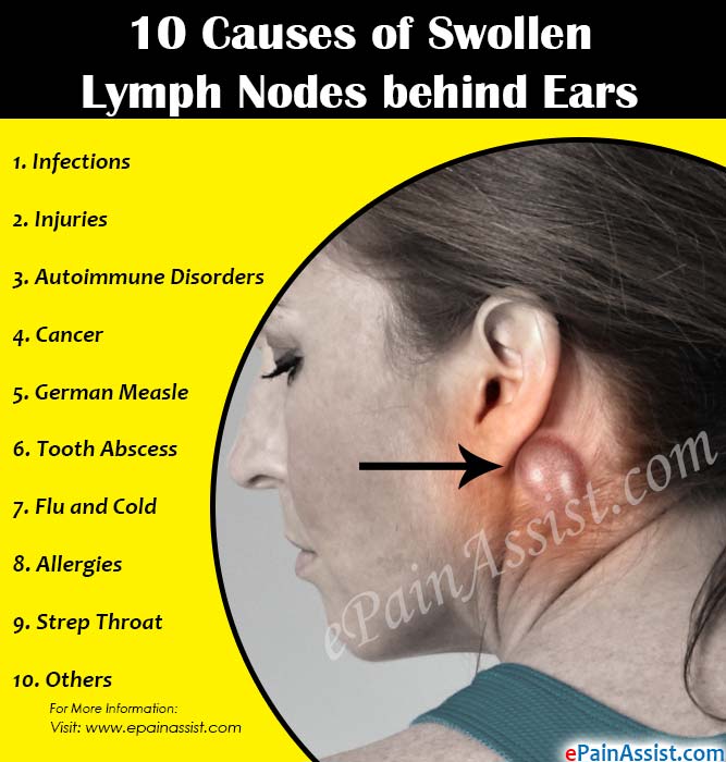 Infected facial lymph node