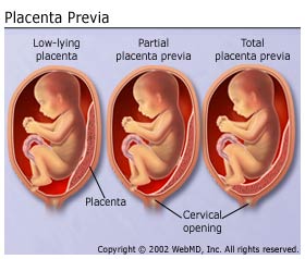best of Lying placenta orgasm Low